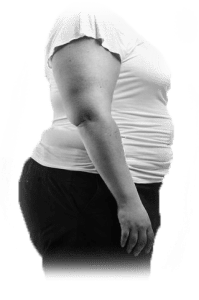 Photo of an overweight woman